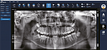 Дентальный 3D томограф EighTeeth FinScan F350 16x10 с ПК, 3 года гарантия