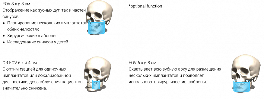 KaVo ProXam 3DQ Pro, FOV до Ø20 × 10 см, сшивание до Ø20 × 17 см