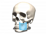 DEXIS OP 3D Pro, PAN, 3D FOV 13 × 15 см и CEPH