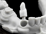 Rapidshape D40 II - 3D-принтер для стоматологии