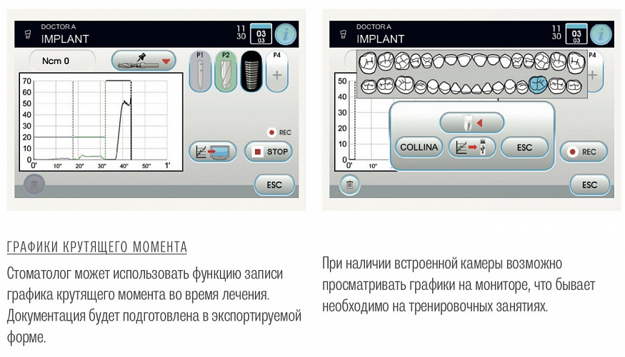 SKEMA 6 - стоматологическая установка Castellini