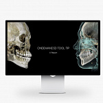 HDX WILL DENTRI-Ca 3D ECO-X, FOV 12 × 10 см, с цефалостатом