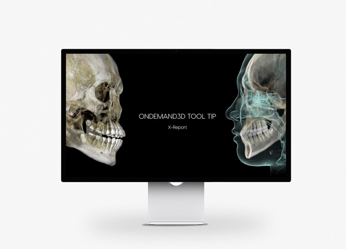 HDX WILL DENTRI-Ca 3D ECO-X, FOV 12 × 10 см, с цефалостатом