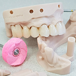 Asiga MAX UV - настольный 3D принтер для стоматологии