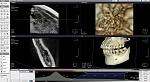 Томограф X-VIEW 3D PAN CEPH (9x9) с цефом