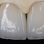 Deprag d5 max