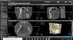 DEXIS OP 3D, PAN, 3D FOV 9 × 14 см и CEPH