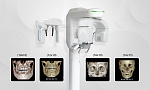 PointNix Point 3D Combi, FOV 16 × 15 см, без цефалостата