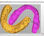 Asiga MAX UV - настольный 3D принтер для стоматологии