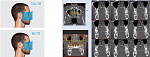 Дентальный 3D томограф NewTom 2D/3D GO (10x10)