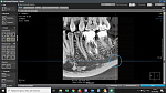 Томограф дентальный OP 3D (11*9 см) без цефалостата