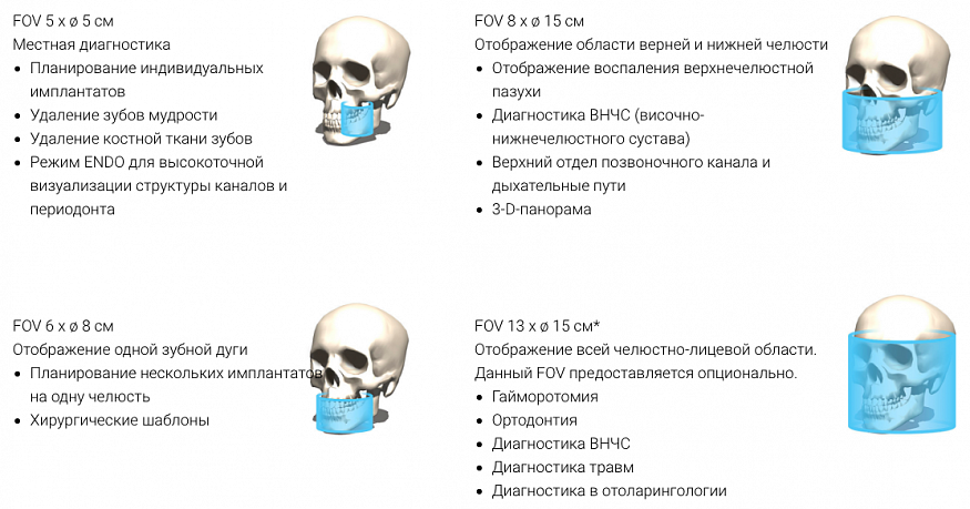 KaVo ProXam 3DQ Pro, FOV до Ø20 × 10 см, сшивание до Ø20 × 17 см