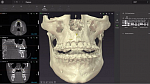 Томограф OP 3D Vision V10, (16*10)