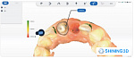 Shining 3D Aoralscan Elite - интраоральный сканер с фотограмметрией
