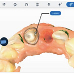 Aoralscan Elite интраоральный сканер