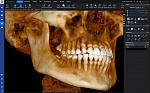 Planmeca ProMax 3D Mid с цефалостатом (20x17) 