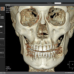 HDX WILL DENTRI-a 3D, FOV 18 × 16,5 см, без цефалостата