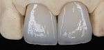 Фрезерный станок Besmile BSM-500D, 5 осей, сухая обработка