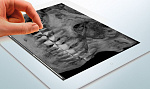 Дентальный цифровой томограф FONA XPan 3D (8,5x8,5)