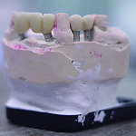 3D сканер Up3D Up1000