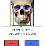 PointNix Point 3D Combi, FOV 16 × 15 см, без цефалостата