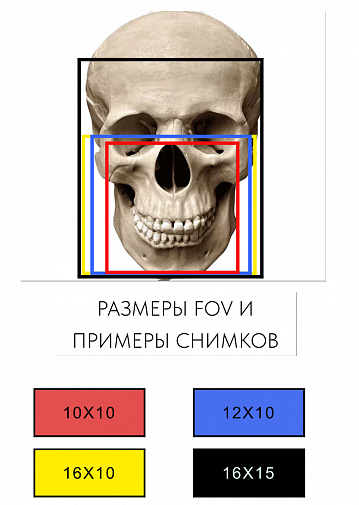 PointNix Point 3D Combi, FOV 16 × 15 см, без цефалостата