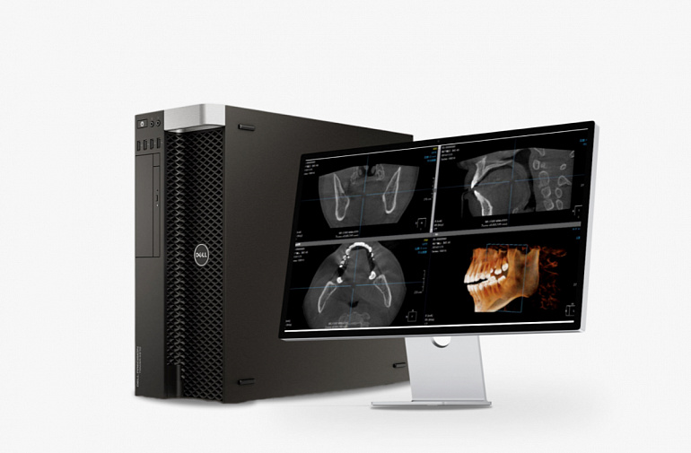 HDX WILL DENTRI-Ca 3D ECO-X, FOV 12 × 10 см