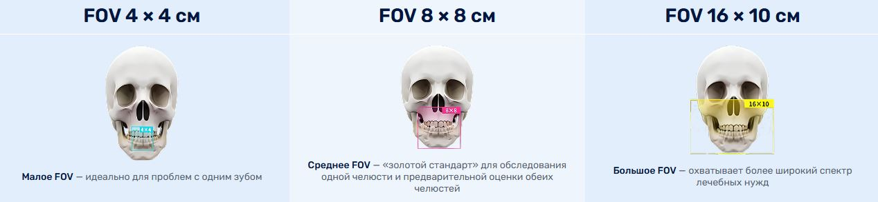 Области 4 × 4, 8 × 8 и 16 × 10 см: схема FinScan F350